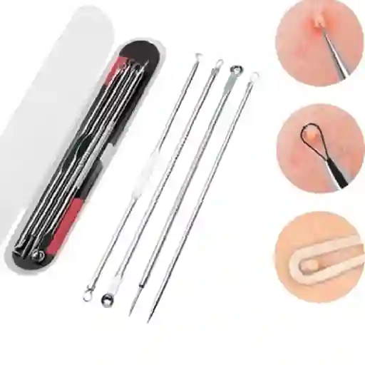 Kit 4 Extractor Removedor De Puntos Negros Y Espinillas