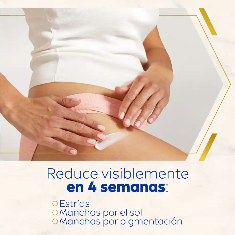 Nivea Body Crema Anti-estrías Luminous 200ml