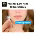 Parches Para Acné Hidrocoloides | 360 Parches Invisible Y Transpirable | Regalos Chic