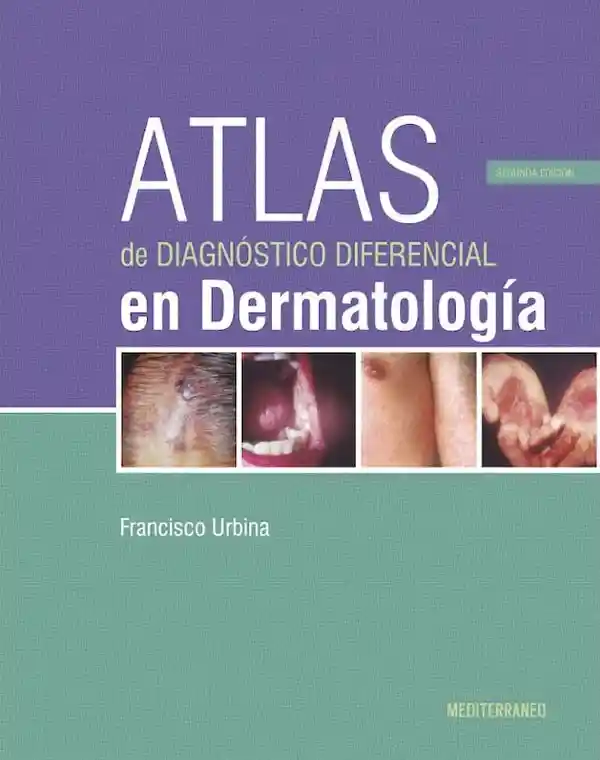 Atlas De Diagnóstico Diferencial En Dermatología